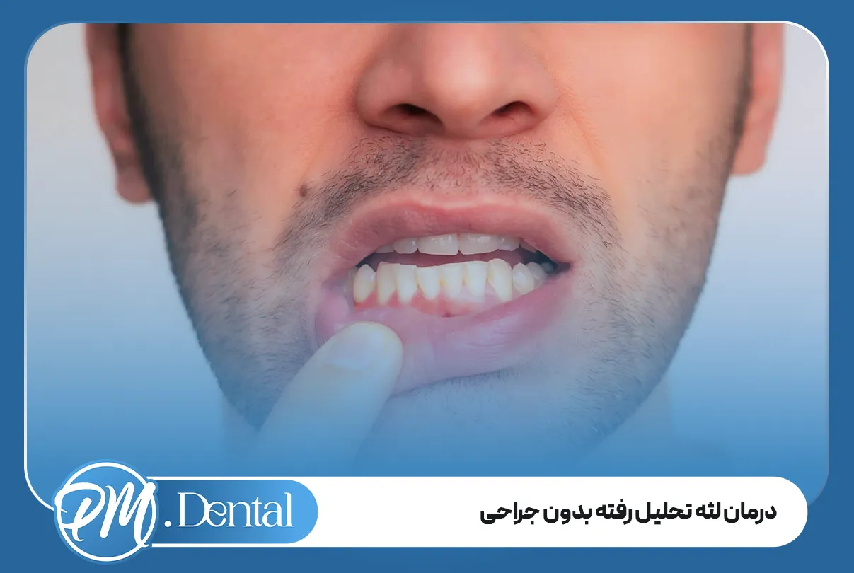 درمان لثه تحلیل رفته بدون جراحی
