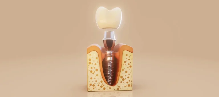 تجربه‌ای متفاوت از مراجعه به دندانپزشکی