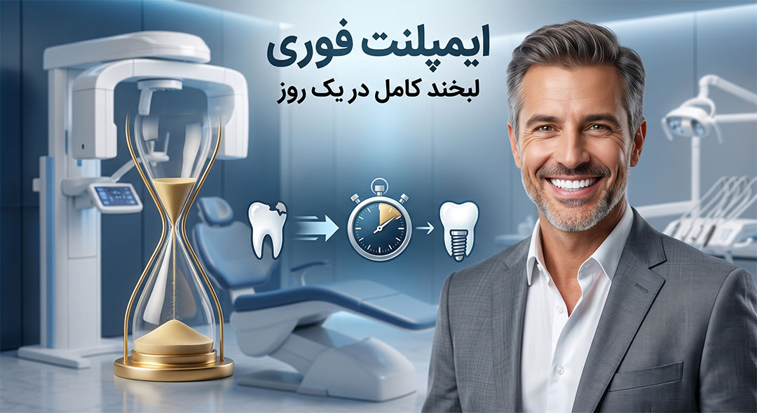 ایمپلنت فوری