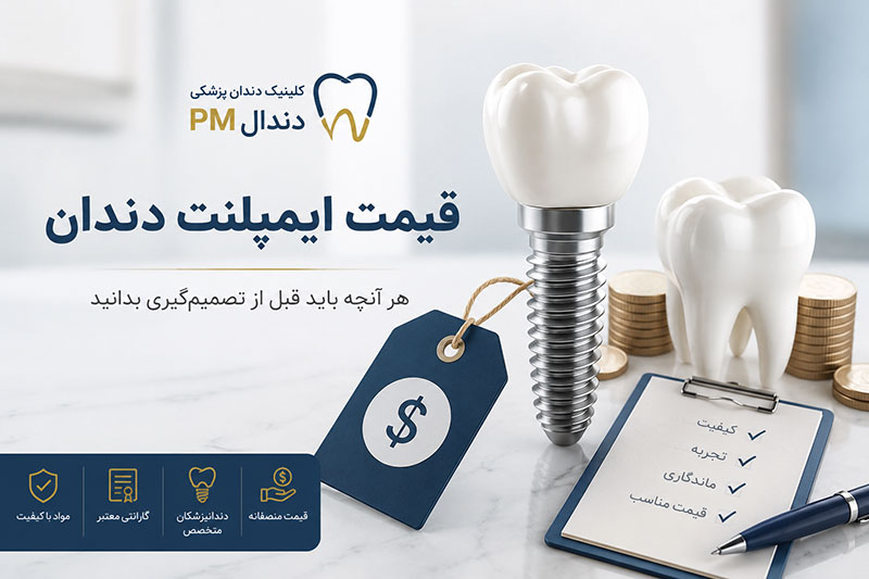 قیمت امپلنت دندان